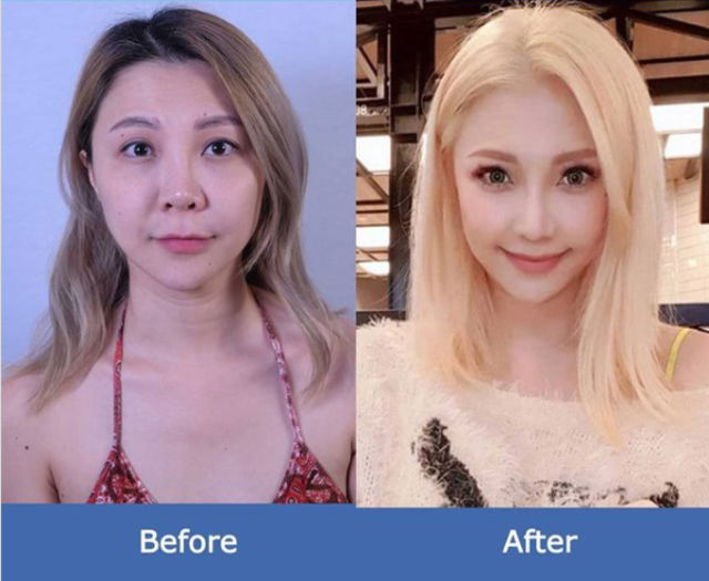 Fotos de antes y después